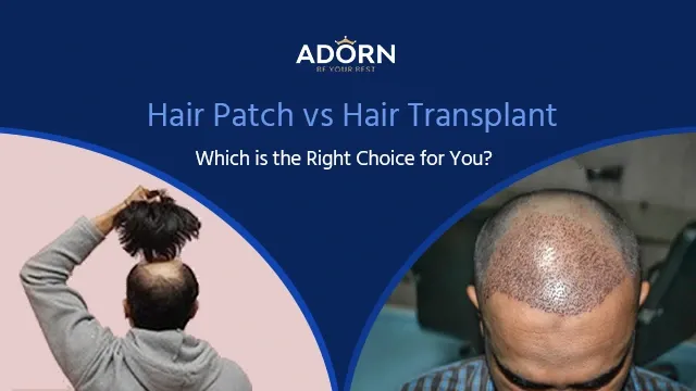 Best natural Hair patch wig in Ahmedabad