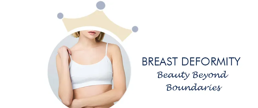 Congenital Breast deformity correction Ahmedabad 