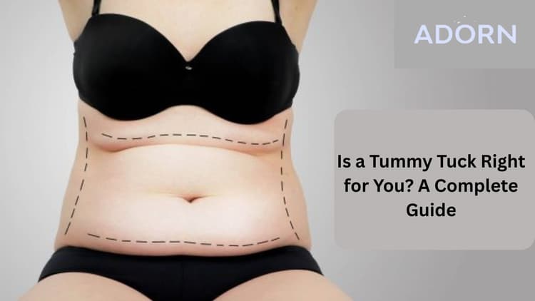 Is a Tummy Tuck Right for You? A Complete Guide