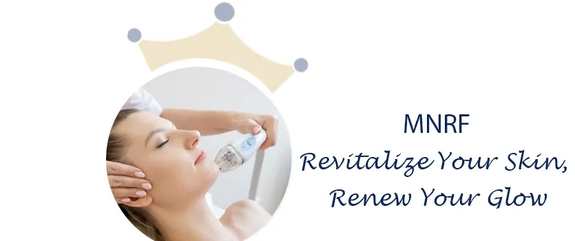 MNRF Morpheus skin tightening Ahmedabad 