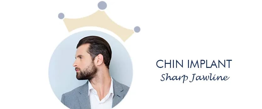 chin implant Ahmedabad India